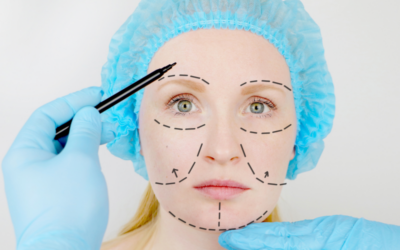 Blefaroplastia Superior e Inferior: Rejuvenescimento e Saúde para seus Olhos