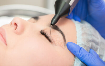 Plasma IQ: Revolução na Medicina Estética e Plástica Ocular